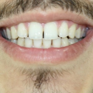 İstanbul Diş Hekimi - MsC Aydın Bilge - Ataşehir Pendik Diş Hekimi