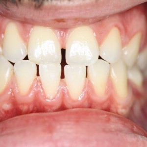 İstanbul Diş Hekimi - MsC Aydın Bilge - Ataşehir Pendik Diş Hekimi