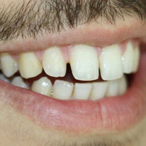 İstanbul Diş Hekimi - MsC Aydın Bilge - Ataşehir Pendik Diş Hekimi