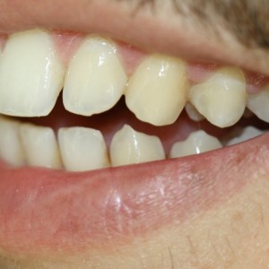 İstanbul Diş Hekimi - MsC Aydın Bilge - Ataşehir Pendik Diş Hekimi