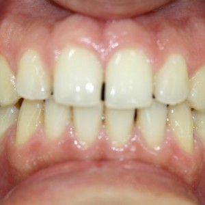 İstanbul Diş Hekimi - MsC Aydın Bilge - Ataşehir Pendik Diş Hekimi