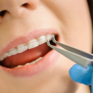 İstanbul Diş Hekimi - MsC Aydın Bilge - Ataşehir Pendik Diş Hekimi