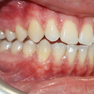 İstanbul Diş Hekimi - MsC Aydın Bilge - Ataşehir Pendik Diş Hekimi