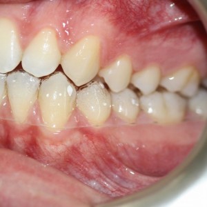 İstanbul Diş Hekimi - MsC Aydın Bilge - Ataşehir Pendik Diş Hekimi