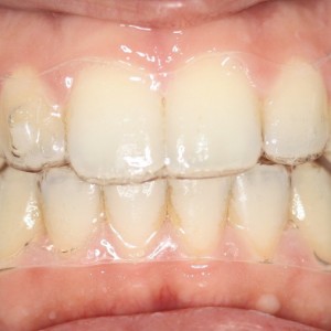 İstanbul Diş Hekimi - MsC Aydın Bilge - Ataşehir Pendik Diş Hekimi