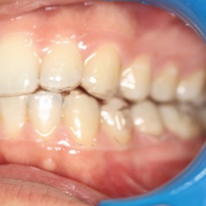 İstanbul Diş Hekimi - MsC Aydın Bilge - Ataşehir Pendik Diş Hekimi