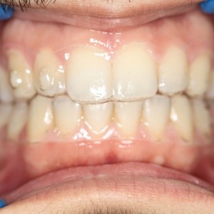 İstanbul Diş Hekimi - MsC Aydın Bilge - Ataşehir Pendik Diş Hekimi