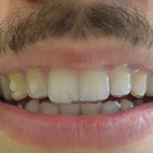 İstanbul Diş Hekimi - MsC Aydın Bilge - Ataşehir Pendik Diş Hekimi