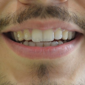 İstanbul Diş Hekimi - MsC Aydın Bilge - Ataşehir Pendik Diş Hekimi