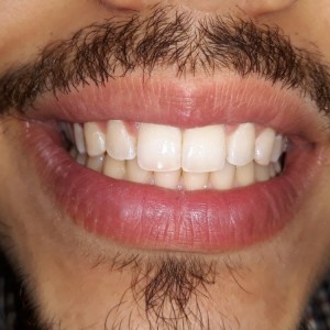 İstanbul Diş Hekimi - MsC Aydın Bilge - Ataşehir Pendik Diş Hekimi