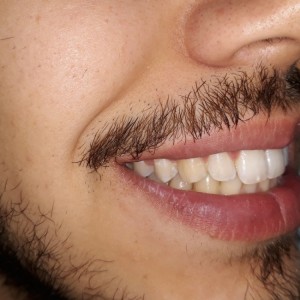 İstanbul Diş Hekimi - MsC Aydın Bilge - Ataşehir Pendik Diş Hekimi