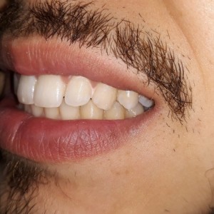 İstanbul Diş Hekimi - MsC Aydın Bilge - Ataşehir Pendik Diş Hekimi